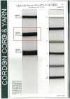 10SCR Silikonbeschichtete Kordel V Rundkordel (mit Kern) 8,5 mm